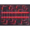 Imbuszkulcs készlet, Strend Pro S239, fekete/piros, 16 részes, gömbfejes 2 - 10 mm, Torx: 10 - 50, T-markolat